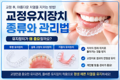 천안 아산 교정 유지장치 리테이너 고정식 가철식 종류 연세발렌타인치과교정과
