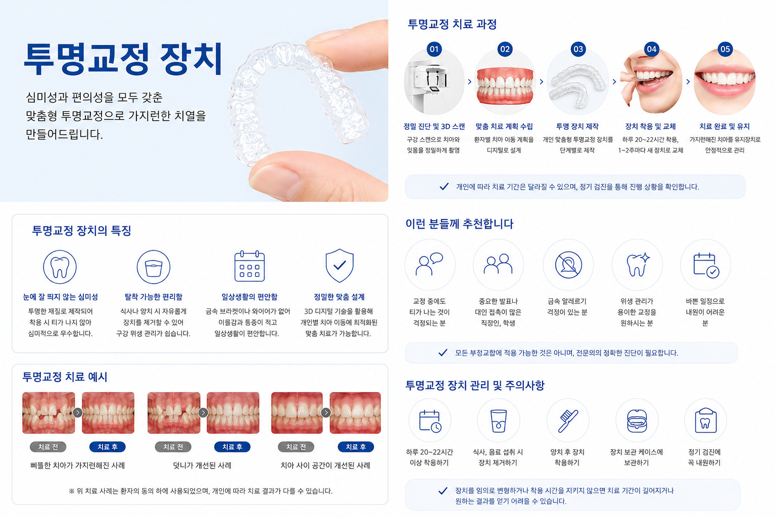 아산 투명교정 투명 교정 장치 착용 설명 연세발렌타인치과교정과
