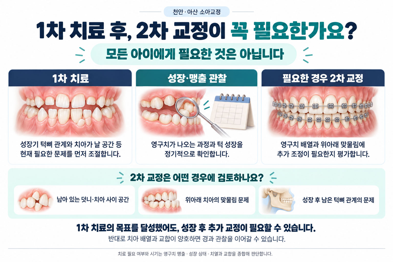 천안 아산 소아교정 1차 치료 2차 교정 차이 단계 설명 연세발렌타인치과교정과